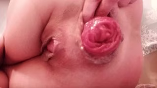 picture-big-anal-prolapse-close-up